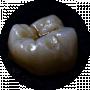 Krona DentLab