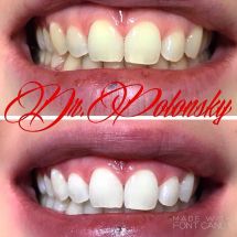 Логотип Dr.Polonsky, стоматологія м. Одеса