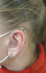 Слух топ, центр реабілітації слуху, слухові апарати фото