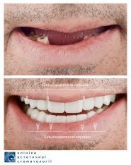 КЭС, клиника эстетической стоматологии фото