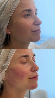 Koshelieva Cosmetology, центр косметології фото