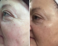 Катерина Левицька, масажист, дієтолог, обгортання фото