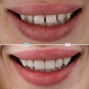 Medora Dental Center, эстетическая стоматология фото