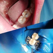 A-z Dent, стоматологія фото