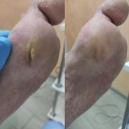 PodoKS, навчально-подологічний кабінет фото