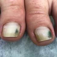 Подологічний кабінет Тетяни Купєєвої фото