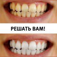 Beauty Smile, студія косметичного відбілювання зубів фото