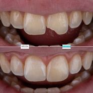 Medora Dental Center, эстетическая стоматология фото
