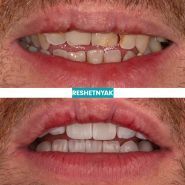 Medora Dental Center, эстетическая стоматология фото