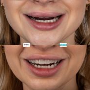 Medora Dental Center, эстетическая стоматология фото