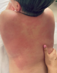 Заплітна Анна, масажист фото