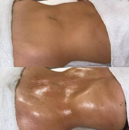 massage kryviyrig фото