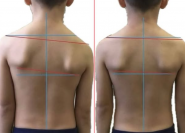 Катерина Левицька, масажист, дієтолог, обгортання фото