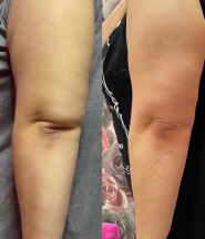 Катерина Левицька, масажист, дієтолог, обгортання фото