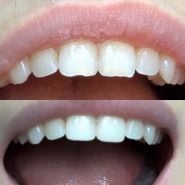 Brilliant Smile, стоматологія фото