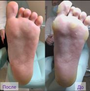 Nuri Care, центр подології Нурі фото