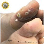 PodoPlex, центр подологии фото