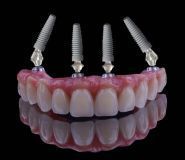 Пальміра Дент, стоматологія фото