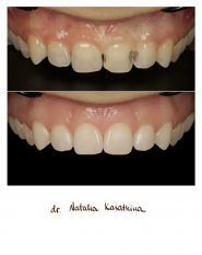 Эстет-Дент, стоматология фото