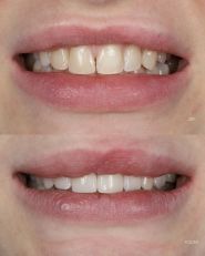Yeremchuk Dental, стоматология фото