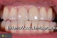 DentaService, стоматологія фото