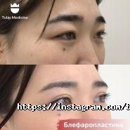 Tulip Medicine, косметологическая клиника фото