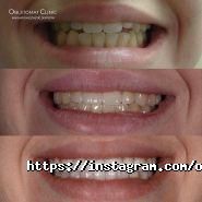 Oblstomat Clinic Innovation Esthetic Dentistry, стоматологія фото