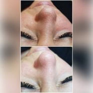 Косметологічний кабінет Анастасії Федчук фото