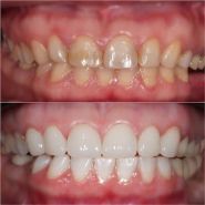 Symmetrica, центр стоматологічного відновлення фото