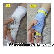 Майстерня руху, центр ортопедичної реабілітації фото