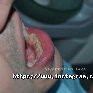 ViVaDent, стоматология фото