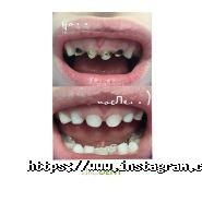 Lekadent, стоматологія фото