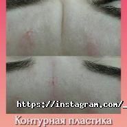 Top Laser, центр естетики фото
