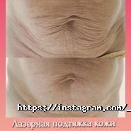 Top Laser, центр естетики фото