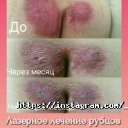 Top Laser, центр естетики фото