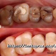 Борденталь, стоматологія фото