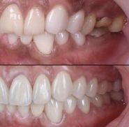 Crystal Dental Studio, стоматологія фото