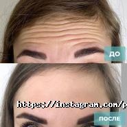 Platinum Laser, Клініка пластичної та естетичної хірургії фото