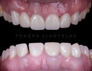 FoxDental, стоматологія фото