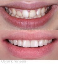 FoxDental, стоматологія фото