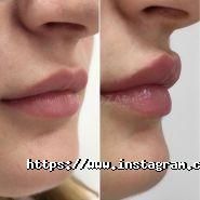 Перлина, клініка пластичної хірургії фото