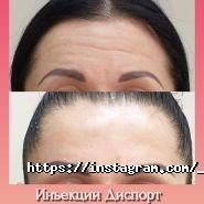 Top Laser, центр естетики фото