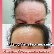 Top Laser, центр естетики фото