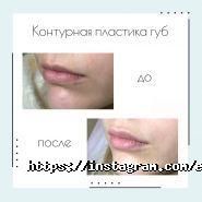 Едіт-Бьюті, косметологія фото