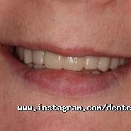 Дентея, стоматологія фото