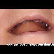 Дентея, стоматологія фото