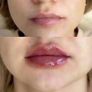 Beauty Shine, студія корекції та естетики тіла фото