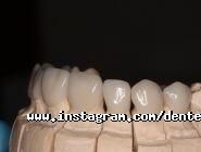 Дентея, стоматологія фото