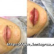 Закревська Ольга, косметолог та дерматолог фото