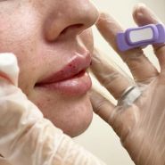 Арлі, лікувальна косметологія та дерматологія фото